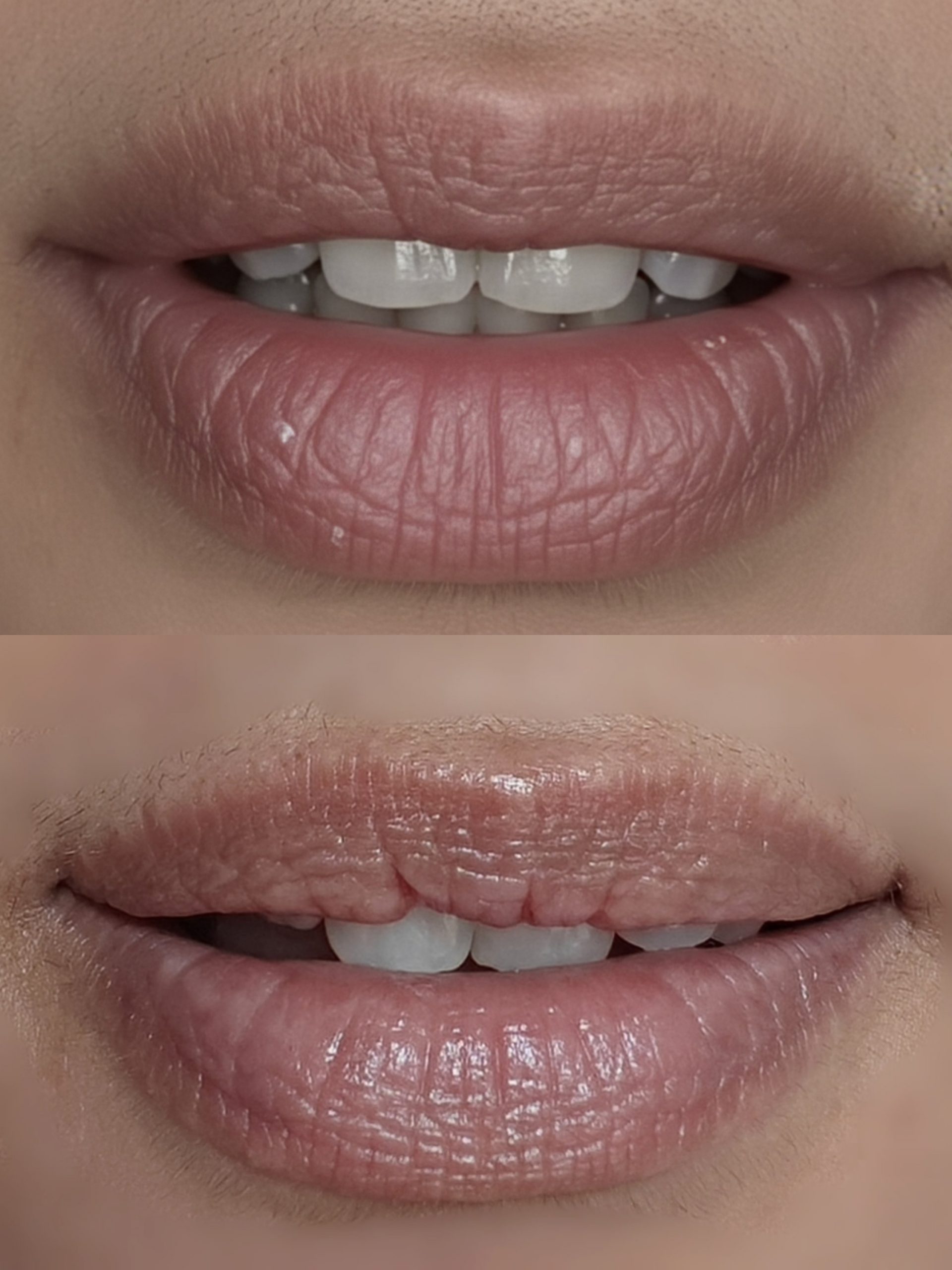 Minty Plump - Non Tinted (peppermint)